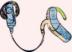 优质的人工耳蜗植入体能满足这些关键需求