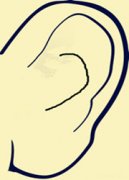 听觉过敏的原因和治疗方法是什么？